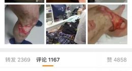 網友反饋的小米MAX手機爆炸，太可怕了